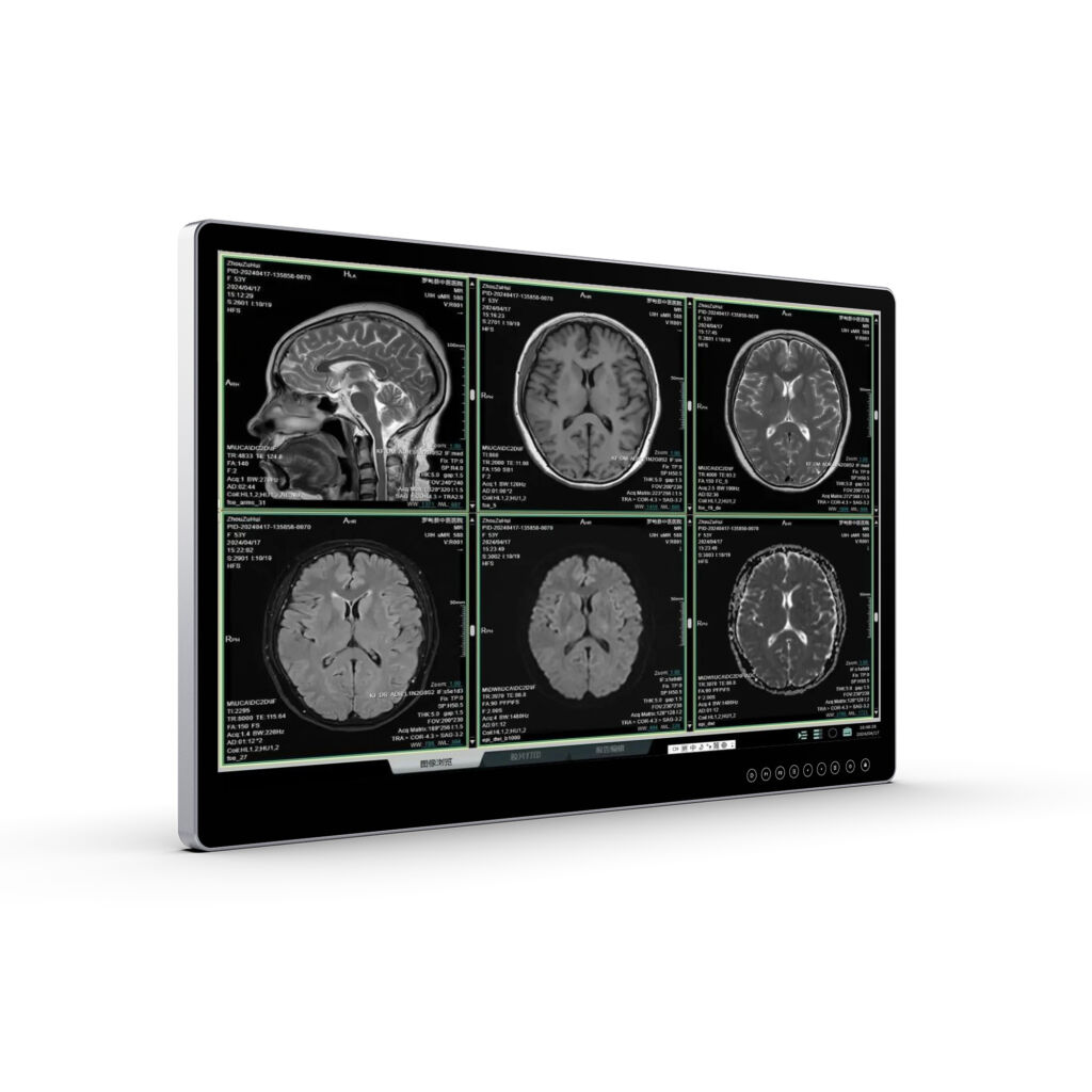 4K Ultra HD Surgical Monitor-MD31